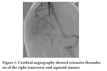 angiography