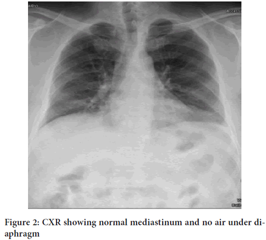 CXR