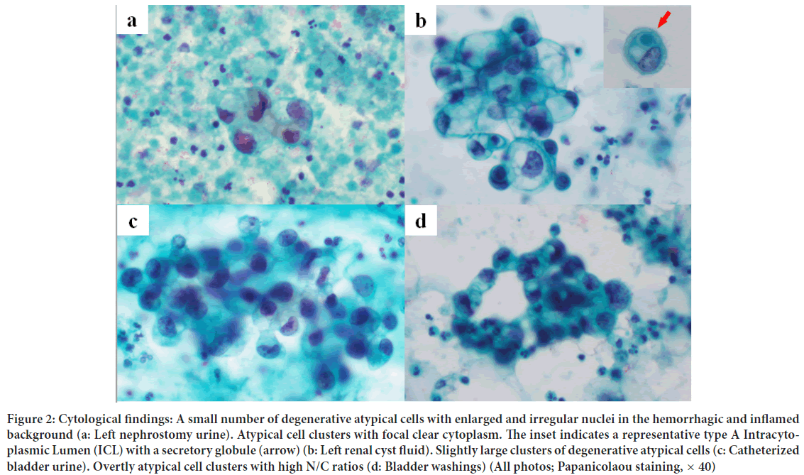 Cytological