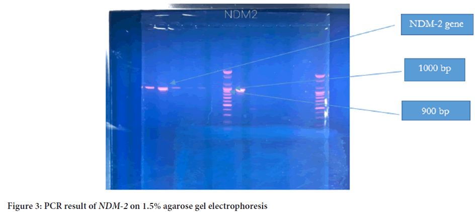 PCR