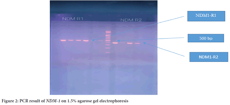 agarose