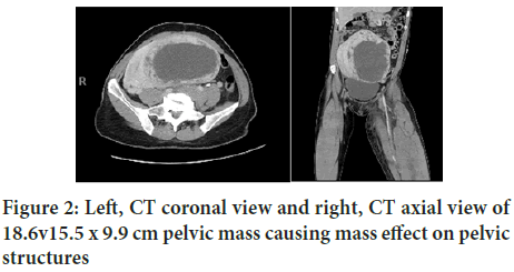 coronal