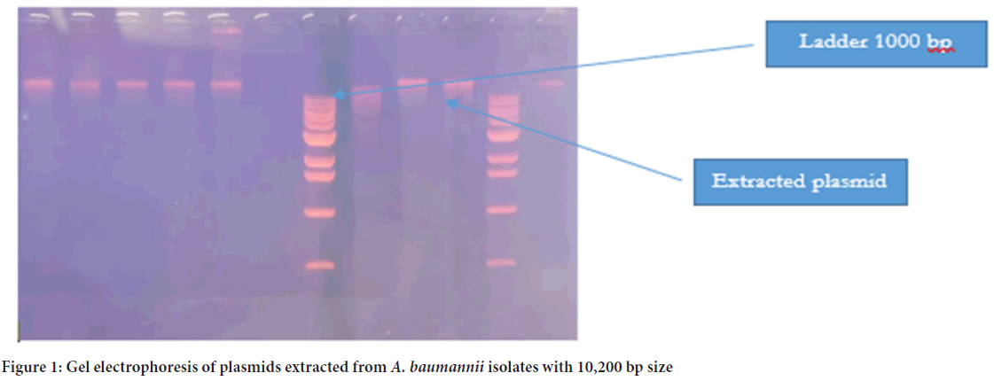 electrophoresis