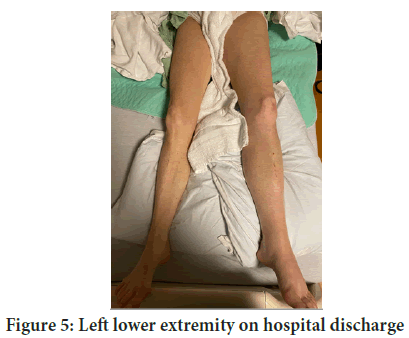 extremity