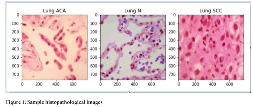 histopathological