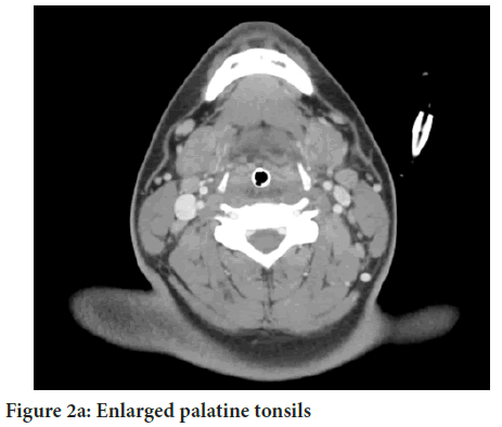 palatine