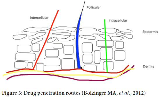 penetration