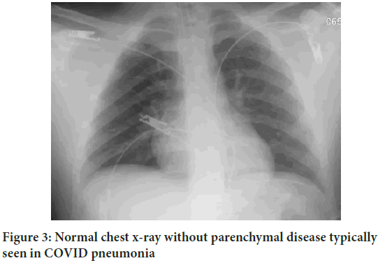 pneumonia