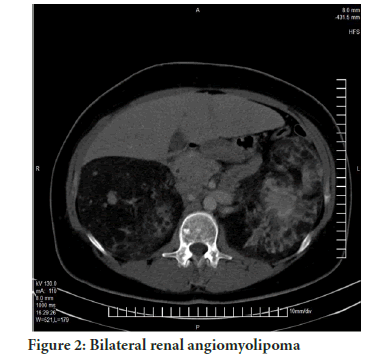 systematicreviews-renal