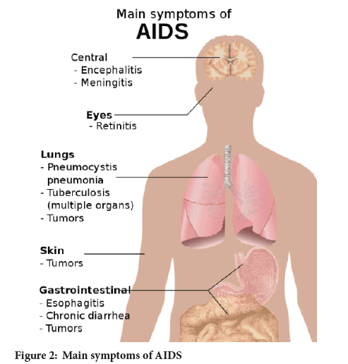 Sysrevpharm-diagram-AIDS