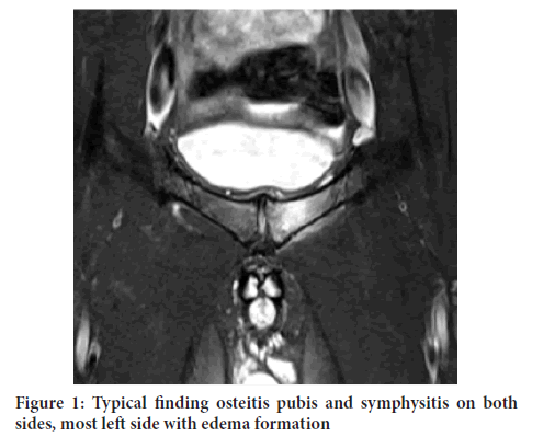 Sysrevpharm-symphysitis