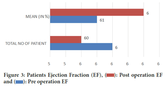 Ejection