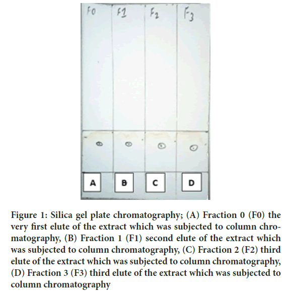 chromatography