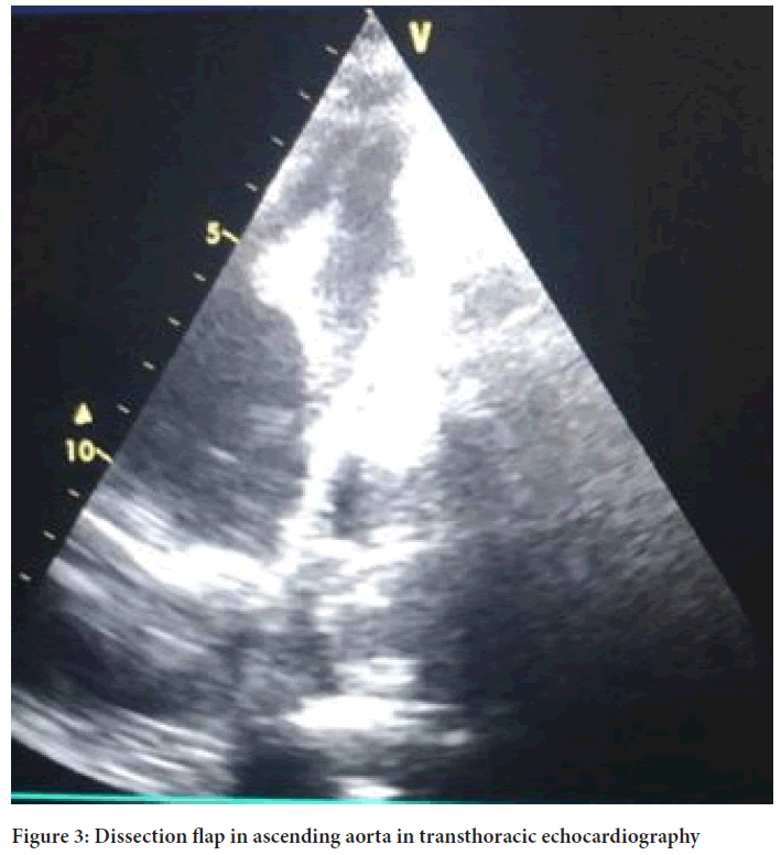 echocardiography