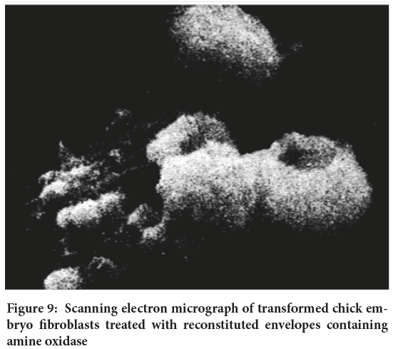 fibroblasts