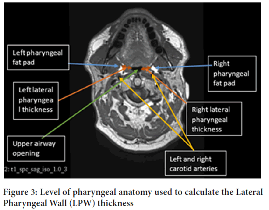 pharyngeal