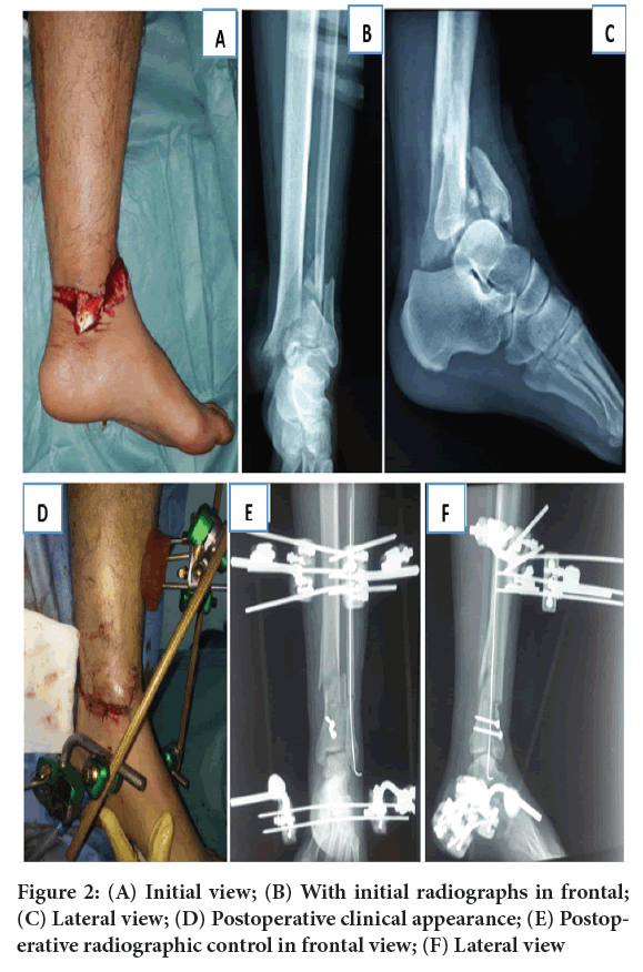 sys-rev-radiographs