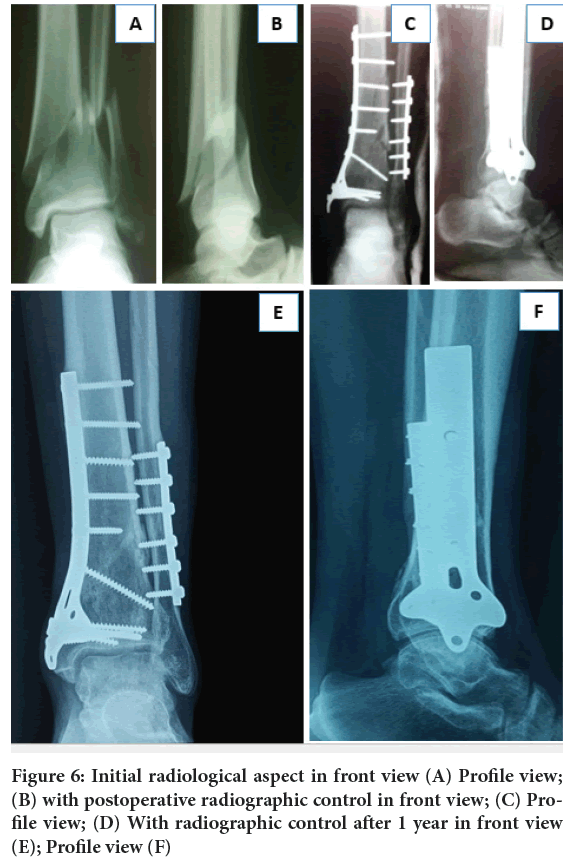 sys-rev-radiological